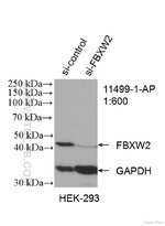 FBXW2-Antibody-11499-1-AP-WB-160481.jpg